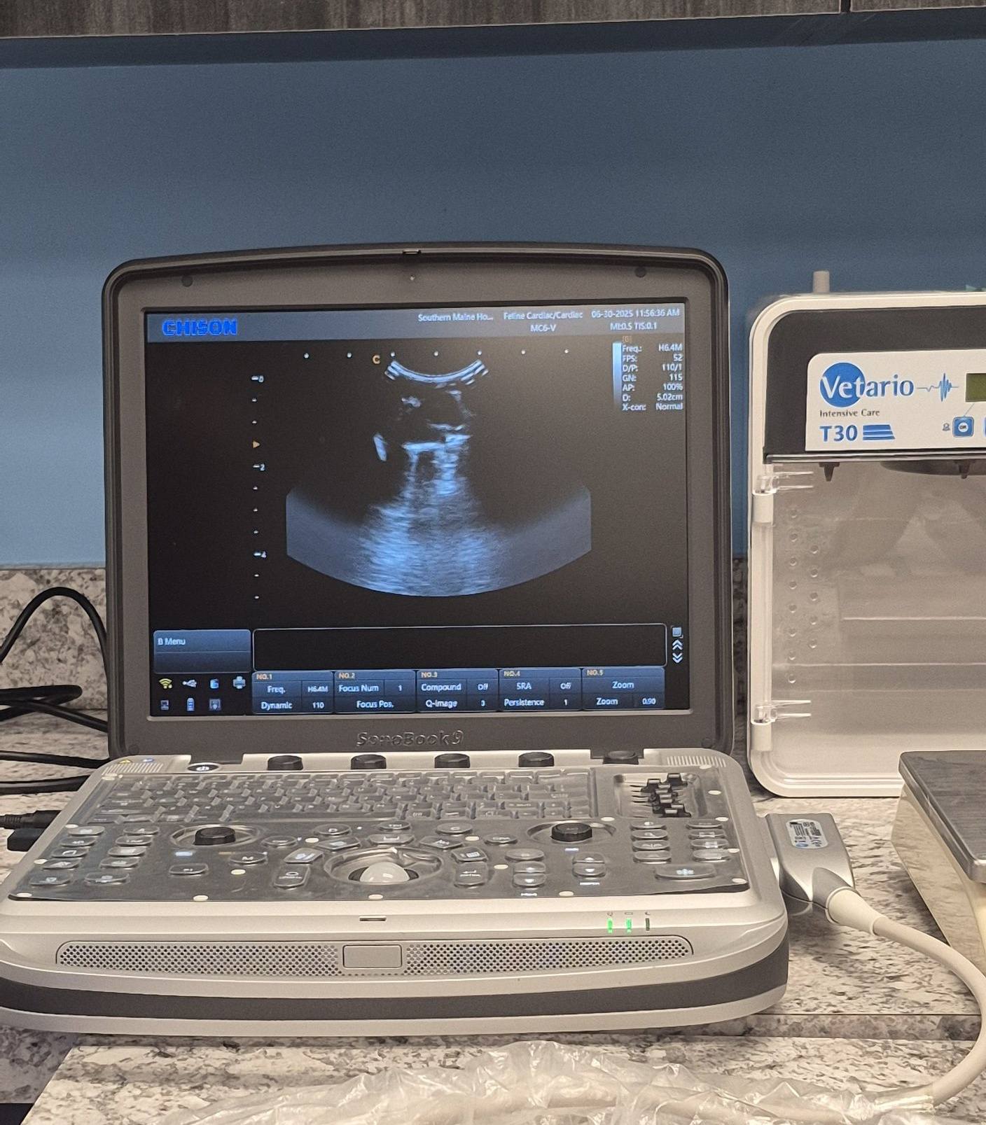 Hero&#39;s Ultrasound