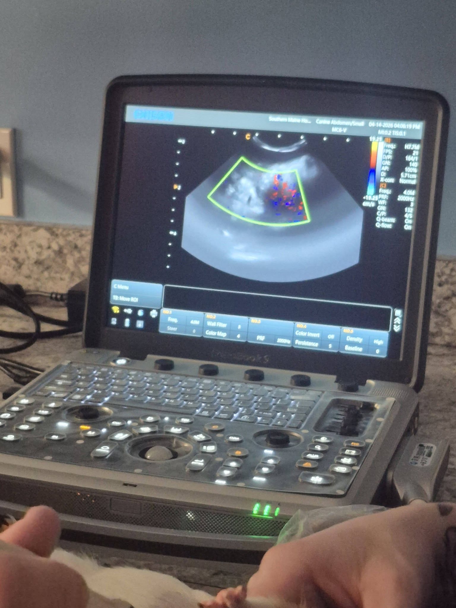 Color Doppler ultrasound showing proper blood flow in Phoenix's liver