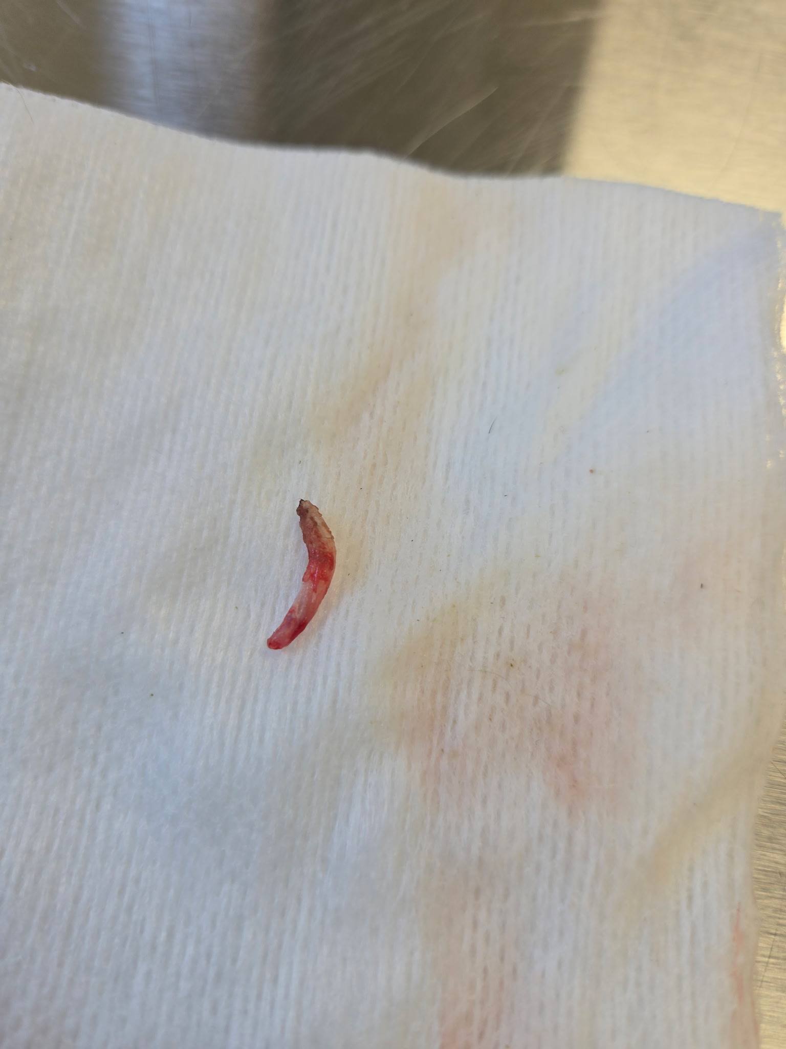 The extracted tooth fragment on gauze