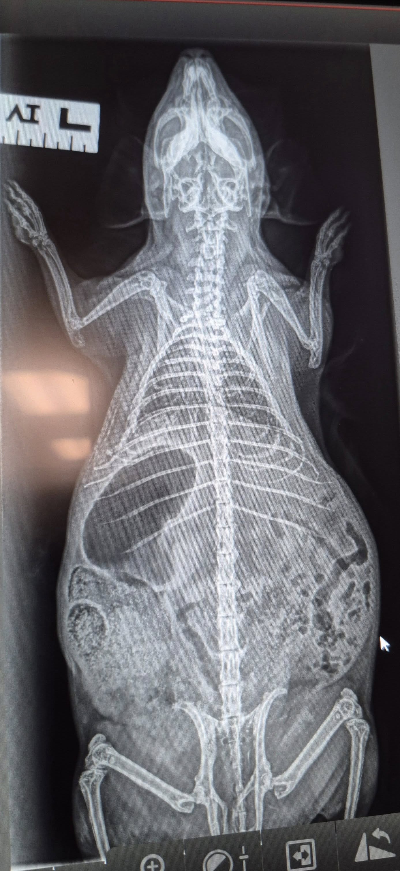 X Ray
